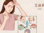 不慎接触艾滋病毒有72小时自救 艾滋病早期可能出现哪些症状