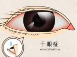 每5人至少有1人患干眼症 中国发病率高达了21%-30%